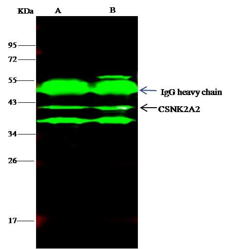 Polyclonal Rabbit anti-Human CSNK2A2 Antibody (Preservative Free, IF, WB)