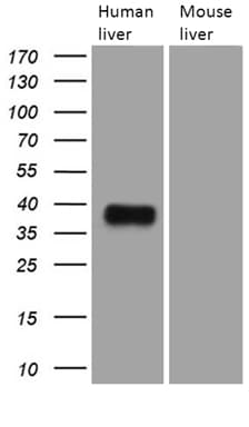 TALDO1 / Transaldolase 1 Antibody (clone OTI2E4)