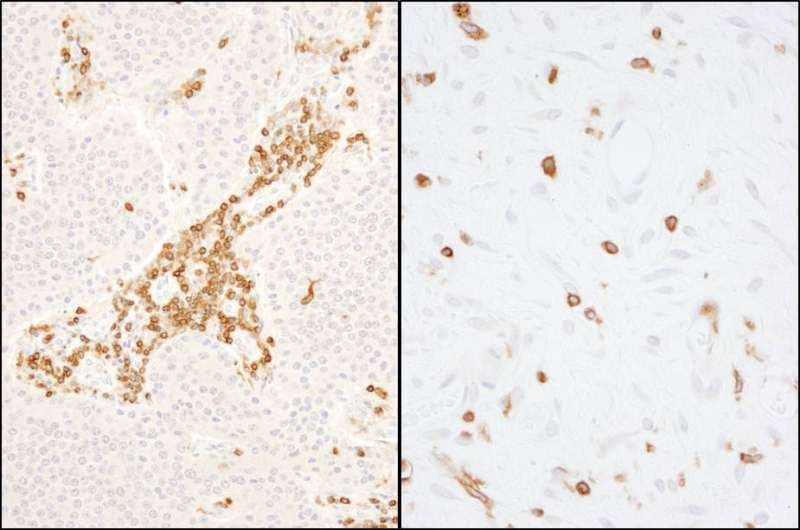 PathPlus™ CORO1A / Coronin 1a Antibody (aa250-300)