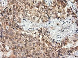 MAPRE2 / EB2 Antibody (clone OTI7A2)