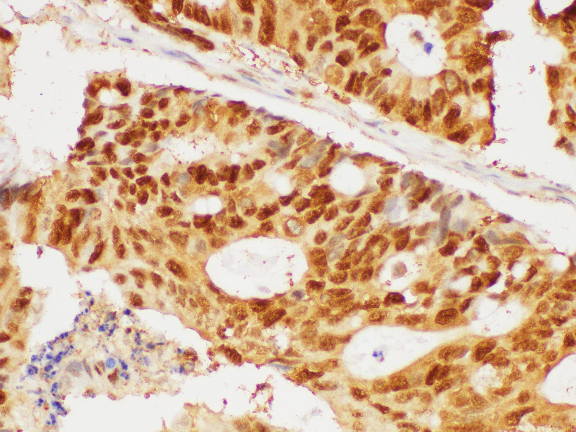 Polyclonal Rabbit anti-Human PCNA Antibody (IHC, WB)