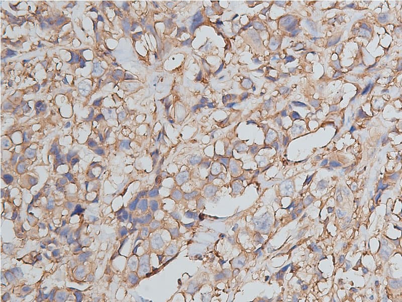 Polyclonal Rabbit anti-Human ANXA2 / Annexin A2 Antibody (IHC, WB)