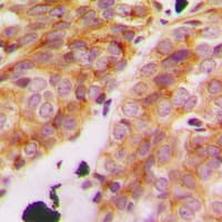 Polyclonal Rabbit anti-Human COL11A1 / Collagen XI Alpha 1 Antibody (Internal, IHC, IF, WB)