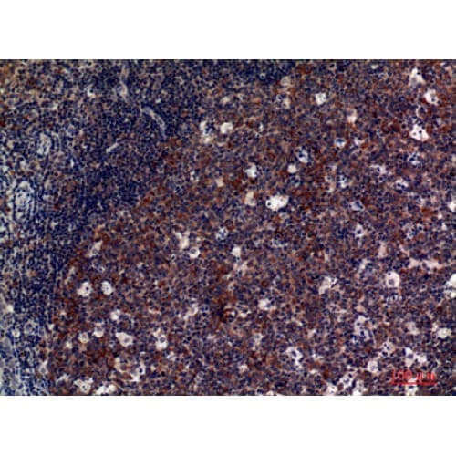 Polyclonal Rabbit anti-Human GPV / CD42d Antibody (331-380 aa, Internal, IHC, WB)