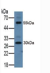 ITLN1 / Omentin Antibody (aa31-253)