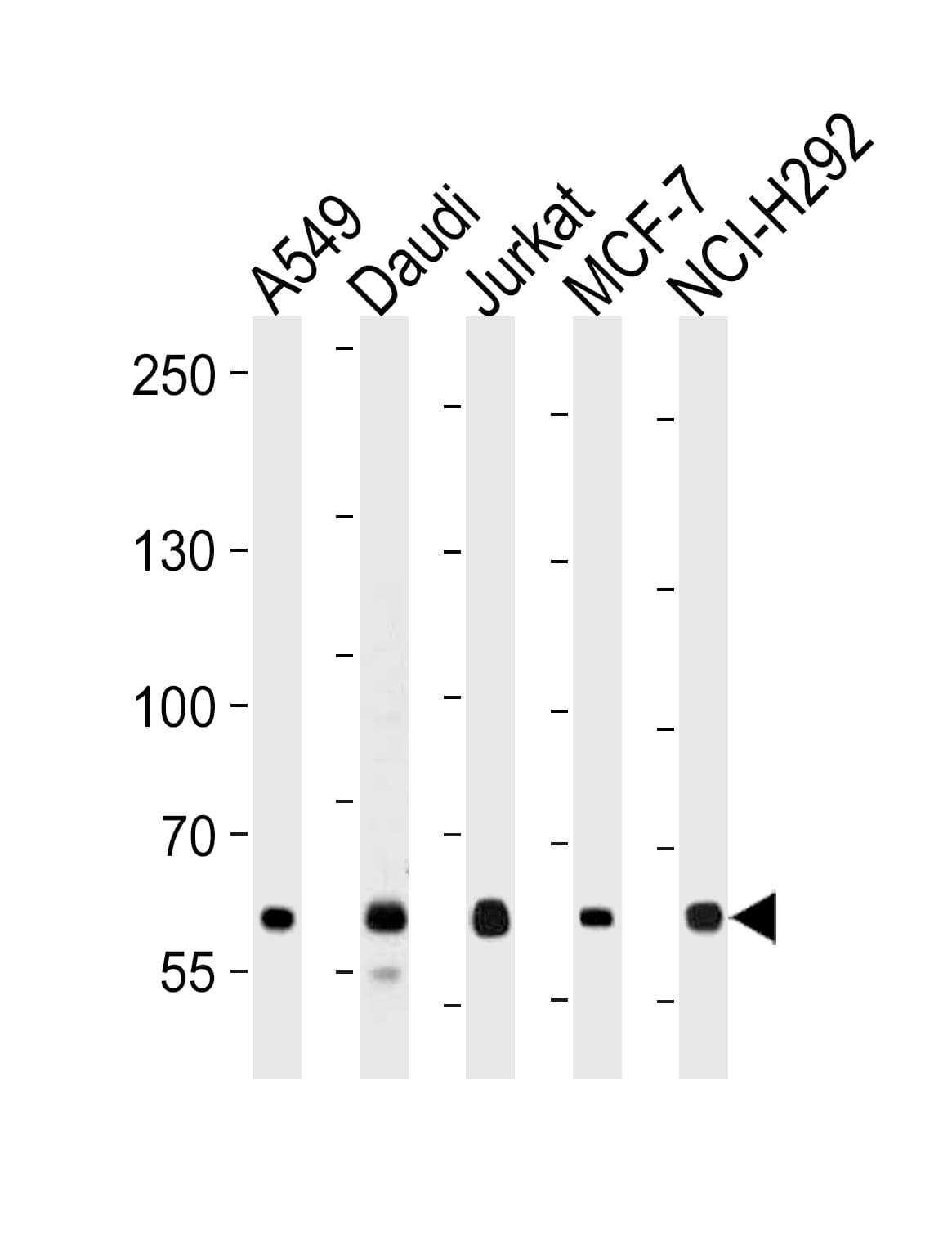 PathPlus™ Polyclonal Rabbit anti-Human FOXP1 Antibody (aa650-677, IHC, WB)