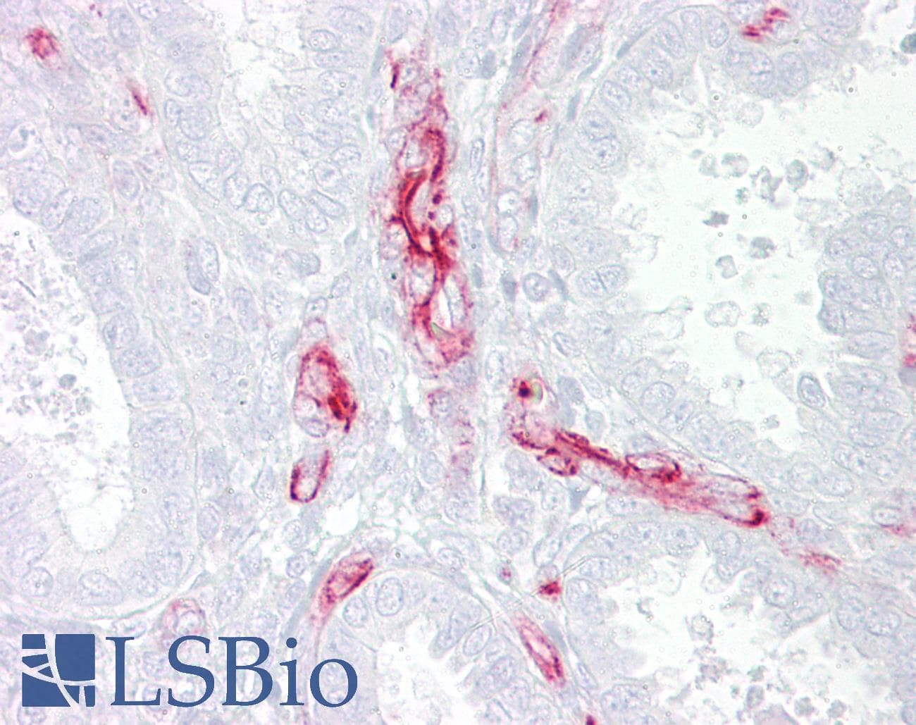 ALK2 / ACVR1 Antibody (aa80-129, HRP)