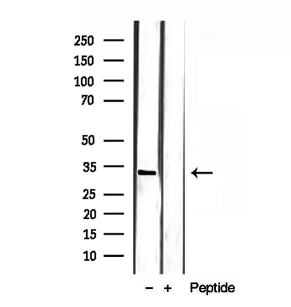 SULT4A1 / Sulfotransferase 4A1 Antibody