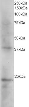 IHC-plus™ SET / TAF-I Antibody (aa2-15)