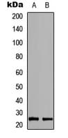 RAB39B Antibody (Internal)
