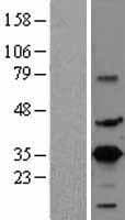 CREM / ICER Protein (Over-Expression Lysate Myc-DDK (Flag))