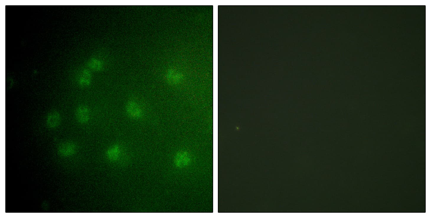 RB1 / Retinoblastoma / RB Antibody (phospho-Thr826)