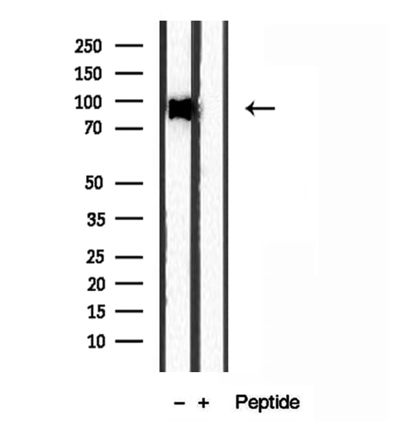 EXOC2 / SEC5 Antibody