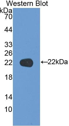 KRT17 / CK17 / Cytokeratin 17 Antibody (aa252-393)