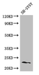 Polyclonal Rabbit anti-Human PEMT Antibody (IF, WB)