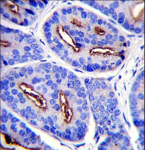 FOLH1 / PSMA Antibody (aa161-190)