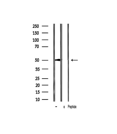 TP53 / p53 Antibody (phospho-Ser20)