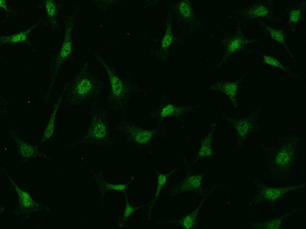 PIK3CB / PI3K Beta Antibody