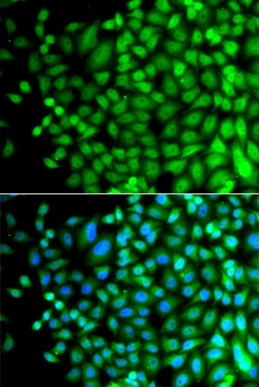 Polyclonal Rabbit anti-Human FAM48A / P38IP Antibody (IHC, IF, WB)