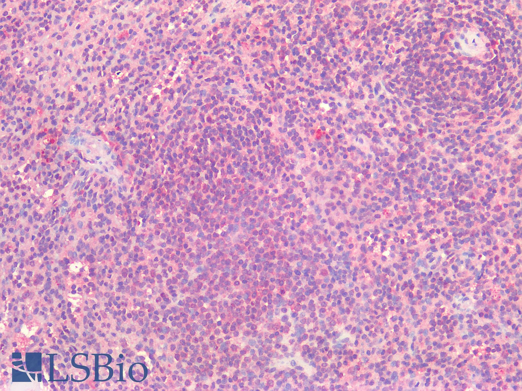 IHC-plus™ HDAC6 Antibody