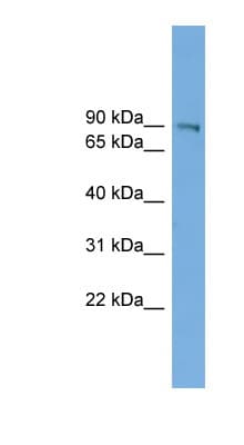 UTP14A Antibody (aa143-192)
