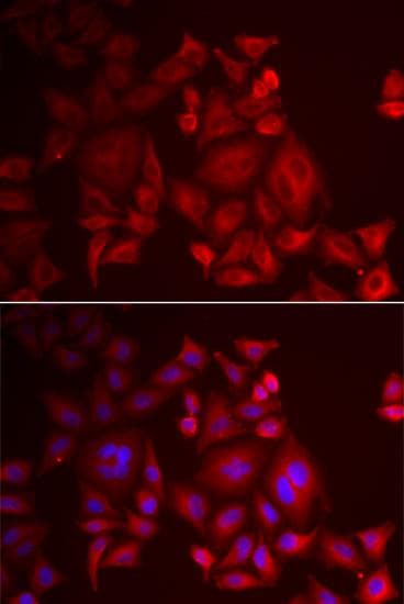 XCL1 / Lymphotactin Antibody