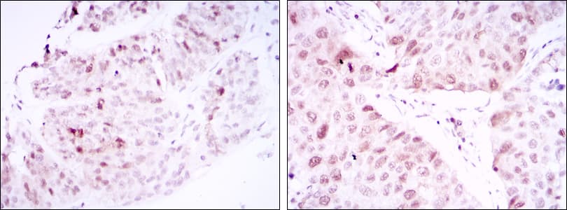 CDK1 / CDC2 Antibody (clone 2G9)