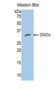 CA2 / Carbonic Anhydrase II Antibody (aa1-260, Biotin)