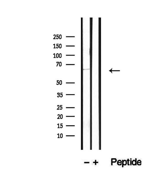 TSH Receptor / TSHR Antibody