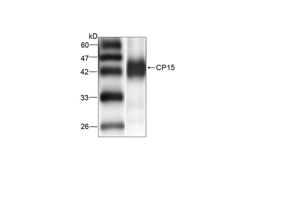 Cryptosporidium CP15/60 Sporozoite 60K Protein Antibody (aa9-156, clone 18)