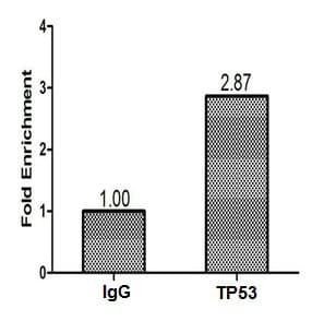 Polyclonal Rabbit anti-Human TP53 / p53 Antibody (aa2-393, IHC, WB)