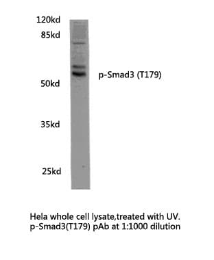 SMAD3 Antibody (phospho-Thr179)