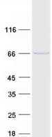 Human FBXO3 Protein (Recombinant Myc-DDK (Flag))