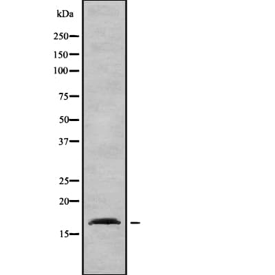 AP2S1 Antibody