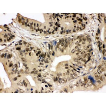 SMC3 / HCAP Antibody (aa1178-1216)