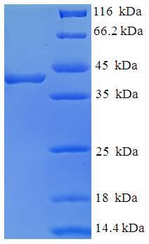 Human FKBP25 / FKBP3 Protein (Recombinant His-SUMO)
