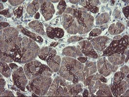 DPH2 Antibody (clone OTI3A12)