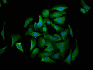 IHC-plus™ Polyclonal Rabbit anti-Human CRADD / RAIDD Antibody (aa1-199, IHC, WB)