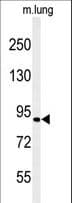 Polyclonal Rabbit anti-Human H6PD / G6PDH Antibody (aa743-769, IHC, WB)