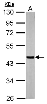 Polyclonal Rabbit anti-Human SUCLA2 Antibody (aa138-416, IHC, WB)