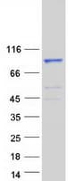 Human NUGGC Protein (Recombinant Myc-DDK (Flag))