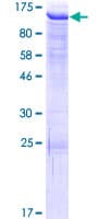 Human ATMIN Protein (Recombinant GST)