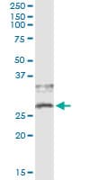 CD79B / CD79 Beta Antibody (clone 4E10-2A10)
