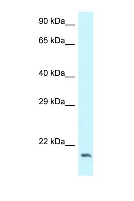 Dynactin 3 / DCTN3 Antibody (C-Terminus)