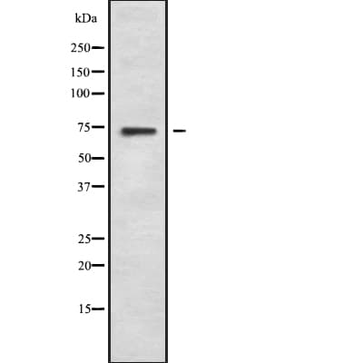 SLC28A1 Antibody