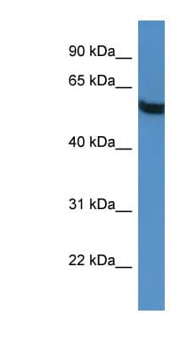 TBC1D10A Antibody (aa391-440)