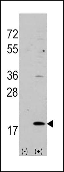 HPCAL1 / Hippocalcin-Like 1 Antibody (aa2-32)
