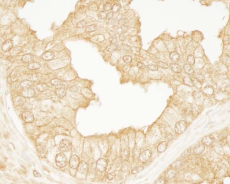 ARHGEF11 Antibody (aa1472-1522)