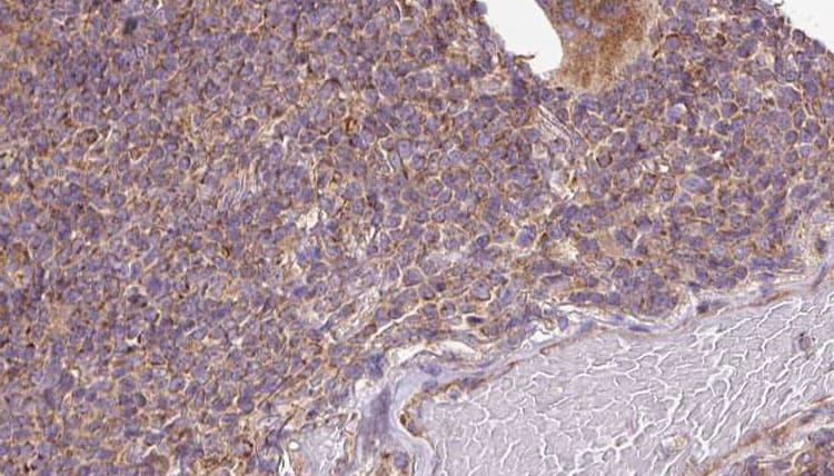 DIAPH1 Antibody