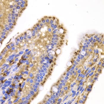 Polyclonal Rabbit anti-Human SMYD4 Antibody (IHC, IF, WB)